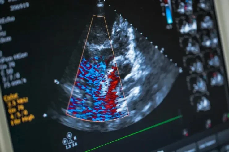 ECHOCARDIOGRAPHY 1