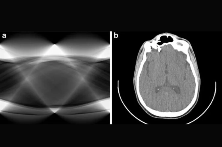 SINOGRAM 1